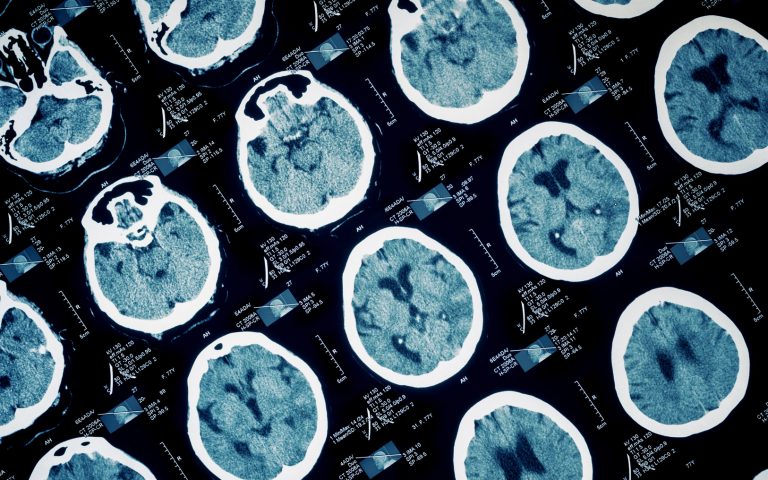Monthly Archives: December 2015	 Lemer and Company client wins medical malpractice trial decision for $1,513,000